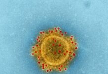 “기분이 우울할 땐 장이 보내는 신호일지도 모릅니다” a yellow substance with red dots in it