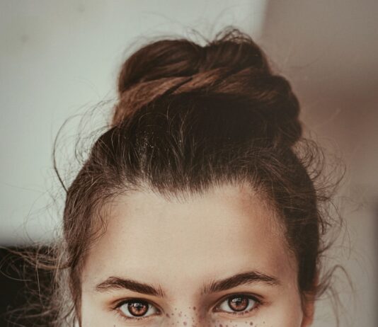 “팔 안쪽에 자꾸 뾰루지가 나요”… 여름철 ‘피지 과다성 뾰루지’, 청결보다 중요한 건? smiling woman holding cheek