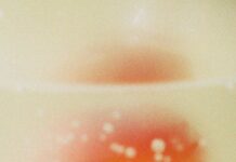 “갑자기 입안이 헐었어요”…초여름 ‘면역 저하’가 만든 구내염 A red and orange blob with white spots.