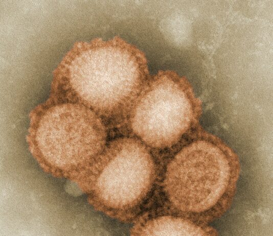 장 건강과 면역력 강화, 건강한 생활습관의 중요성 a picture of a bunch of balls on a table