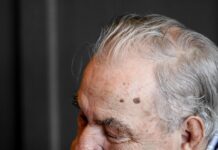 뇌 건강 지키고 치매 예방하는 5가지 생활 습관 man holding chin