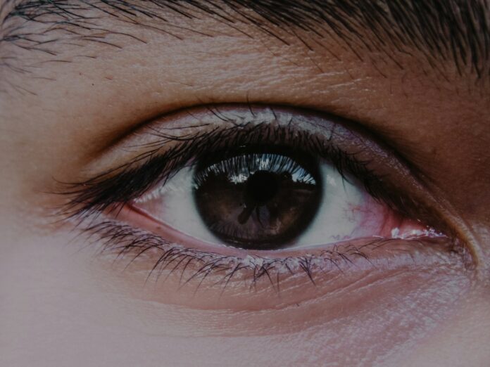 person's right eye