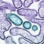 한국, 니파 바이러스 ‘제1군 감염병’ 지정… 최고 수준 대응 체계 가동 a close up of an animal cell with blue cells