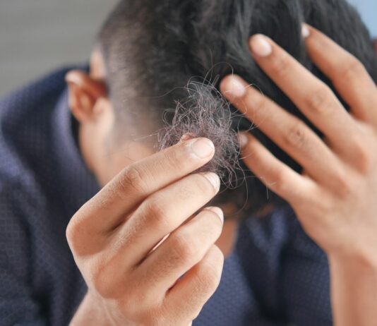 “두피 건강이 아름다운 머릿결의 시작” a man is combing his hair with his hands